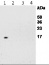 RPS14 | 40S ribosomal protein S14-1 